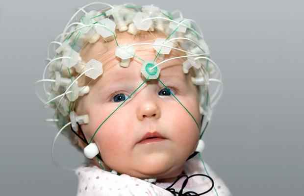 у ребёнка  на  голове  электроды от  ЭЭГ